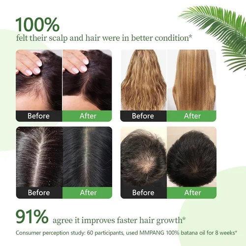 Miniatura 4 de Aceite de batana para el crecimiento del cabello, aceite orgánico crudo para el cabello, aceite natural prensado en frío para botellas de vidrio