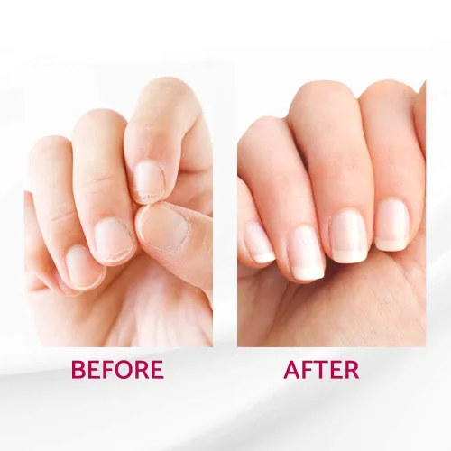 Miniatura 5 de IBD Reconstrux - Tratamiento de reparación de uñas, fortalecedor de uñas para uñas débiles y dañadas, tratamiento de crecimiento de uñas para pelar