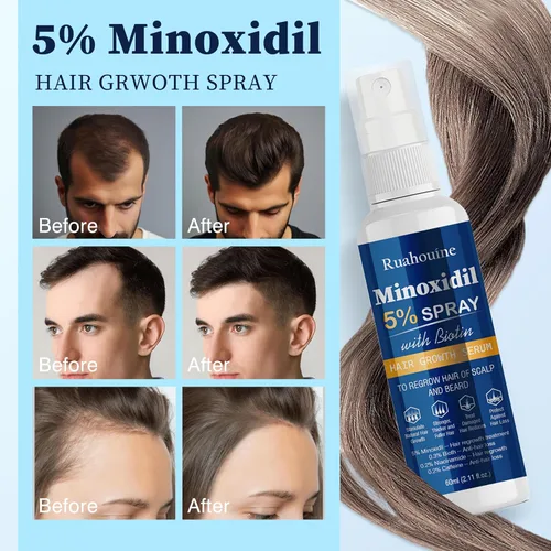 Miniatura 4 de Suero en aerosol para el crecimiento del cabello de minoxidil al 5 %, tratamiento para el crecimiento del cabello para hombres y mujeres, fortalece