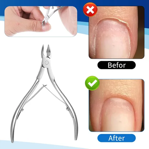 Miniatura 6 de Kit de herramientas de pedicura para quitar uñas encarnadas, de acero inoxidable, lima y levantadores de uñas, herramienta profesional de pedicura