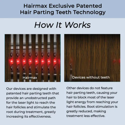 Miniatura 5 de Hairmax Ultima 12 LaserComb - (FDA Aprobado) Dispositivo de Tratamiento de Rebrotes Láser para Hombres y Mujeres - Revierte la Pérdida de Cabello
