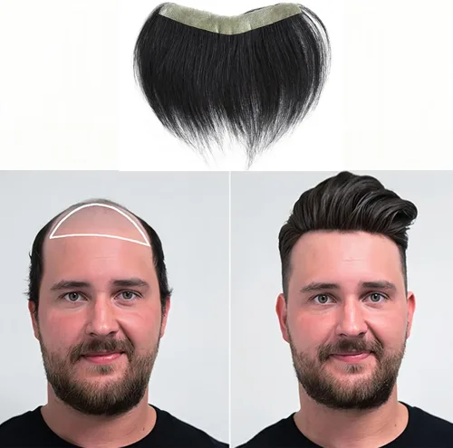 Miniatura 26 de Extensión frontal de cabello rubio claro para hombres, extensión de cabello lacio con pérdida de línea de cabello humano con cinta adhesiva