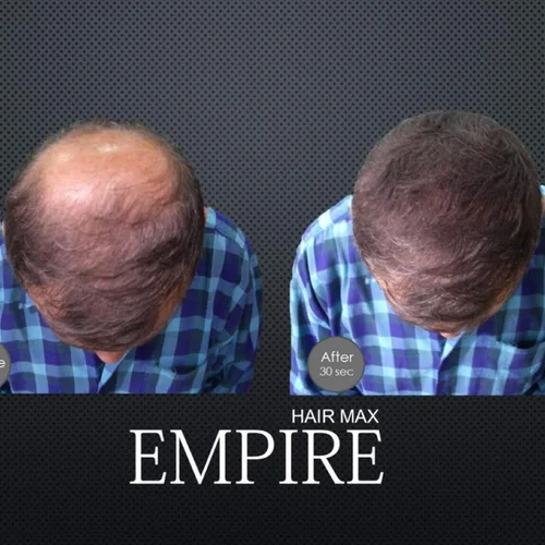 Miniatura 5 de Empire Hair Max - Corrector de pérdida de queratina para aumentar la pérdida de queratina (0.88 onzas) (gris)
