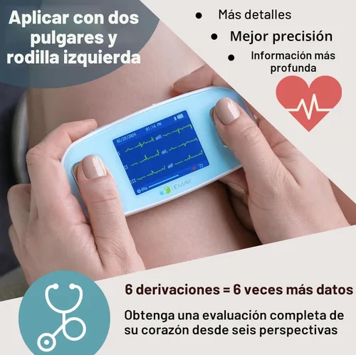 Miniatura 3 de EMAY 6L Monitor ECG portátil Graba ECG y frecuencia cardíaca en 6 canales Compatible con Smartphone y PC No se requiere suscripción