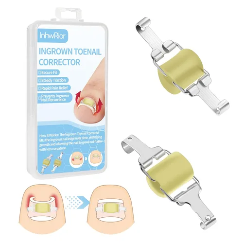 InhwRior Corrector de uñas encarnadas, fácil aplicación en casa, ajuste seguro (sin deslizamiento), tracción constante para alivio rápido del dolor,