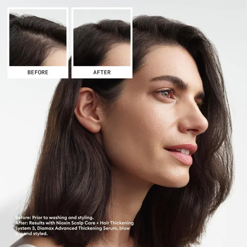 Miniatura 2 de Nioxin System 3 - Champú para el cuero cabelludo + engrosamiento del cabello, para cabello teñido, seco y dañado con ligero adelgazamiento, mantiene