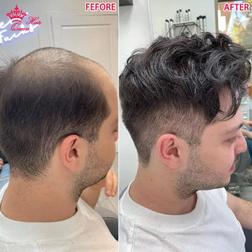 Miniatura 6 de Toupee - Peluca de encaje frontal y mono para hombre, prótesis de cabello masculino duradero, peluca tipo tupé para hombres, unidad de sistema