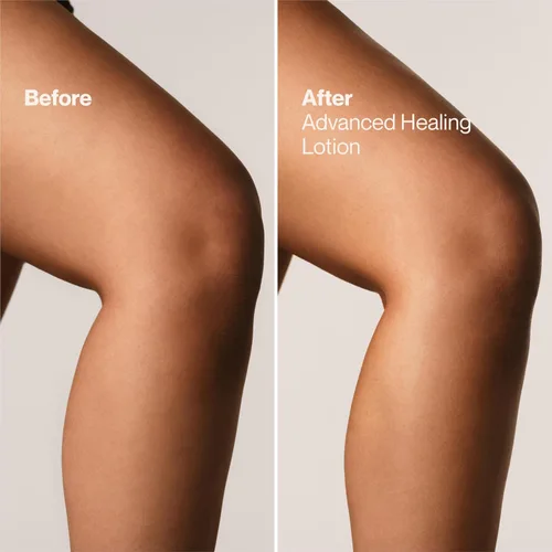 Miniatura 8 de Suave + Loción curativa avanzada para manos y cuerpo para mujeres con ceramidas para piel muy seca, hidratante, no grasosa, crema hidratante sin
