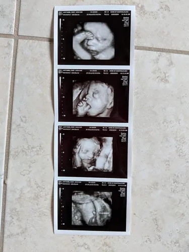 Miniatura 2 de Broma 3D personalizada tira de ultrasonido falso de 4 fotos