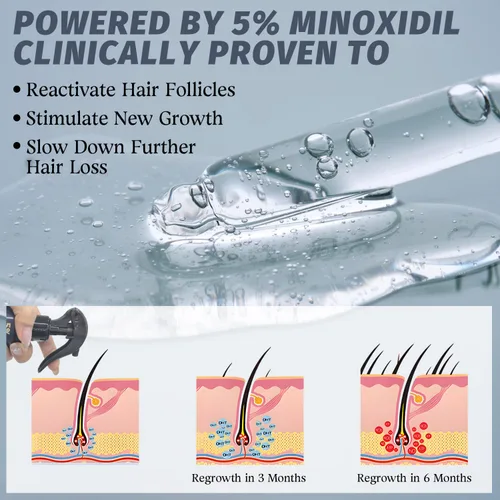 Miniatura 4 de Spray de minoxidil al 5% para el crecimiento del cabello, hombres y mujeres, tratamiento para adelgazamiento y retroceso de la línea del cabello