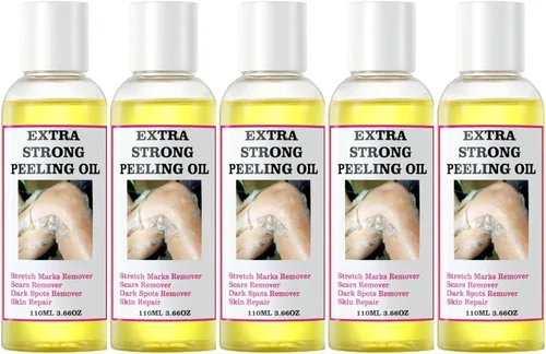 Miniatura 10 de Aceite de pelado amarillo, aceite de pelado fuerte para piel oscura, extra fuerte, solución exfoliante para el cuerpo, todo tipo de piel, removedor