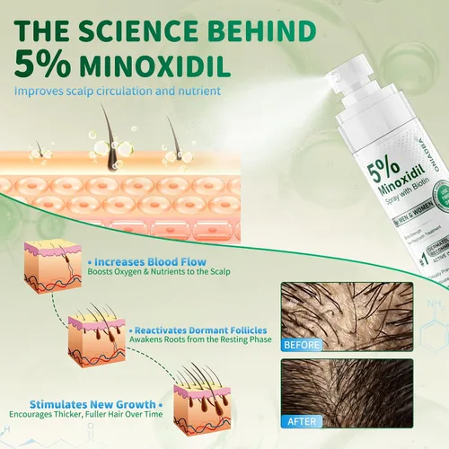 Miniatura 4 de Spray de minoxidil al 5 % para el crecimiento del cabello, paquete de 4 (8.12 onzas), para hombres y mujeres, tratamiento de crecimiento del cabello