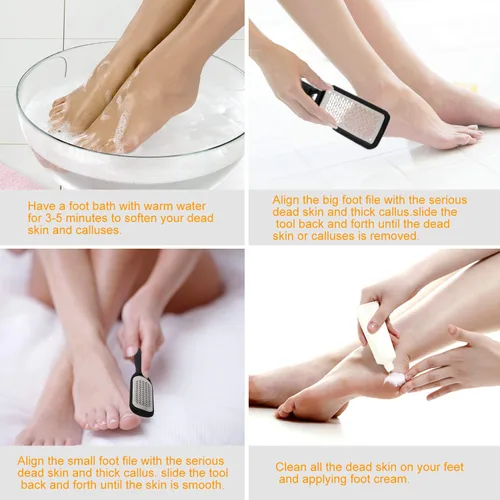 Miniatura 5 de Removedor de callos para pies, raspador de pies colosal y kit profesional de pedicura para eliminar la piel dura para pies húmedos y secos, lima