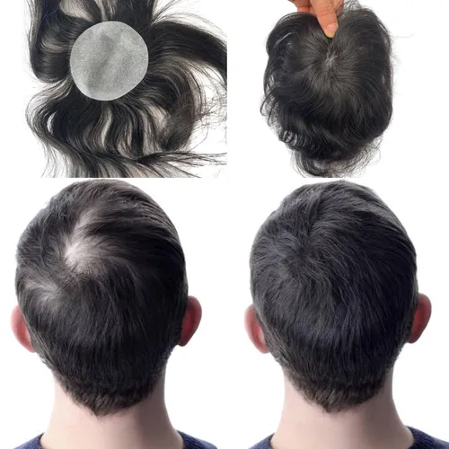 Miniatura 8 de Voloria Parche para el cabello calvo para hombres, 3.15 x 3.15 pulgadas, sistema de reemplazo de cobertura completa de piel de poliuretano