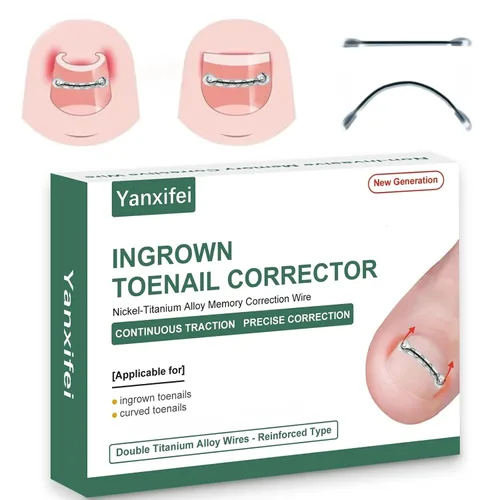 Corrector de uñas encarnadas de nitinol dual, tratamiento de uñas encarnadas, enderezador de uñas curvas, kit de eliminación de uñas encarnadas,
