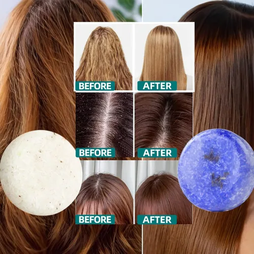 Miniatura 3 de DBEAUTYM Paquete de 2 barras de champú para el cabello con lavanda y romero, limpieza profunda para la pérdida de cabello del cuero cabelludo