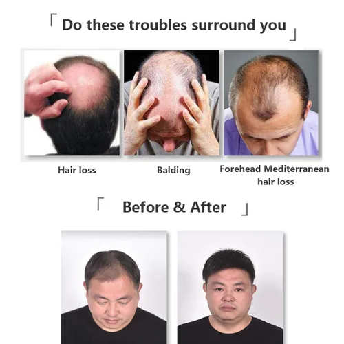 Miniatura 5 de viviaBella Extensión de cabello humano tipo tupé de encaje atado a mano con clip, extensiones de cabello para hombres con pérdida de cabello, negro