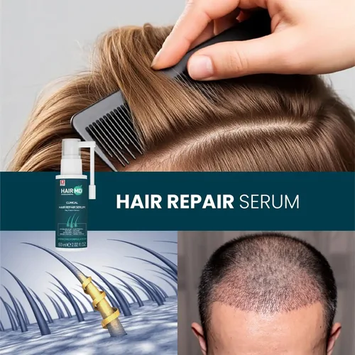 Miniatura 8 de HairMD Transplant Clinical Repair Serum - Suero de recrecimiento del cabello de 2.0 fl oz - Previene la pérdida de cabello después del trasplante