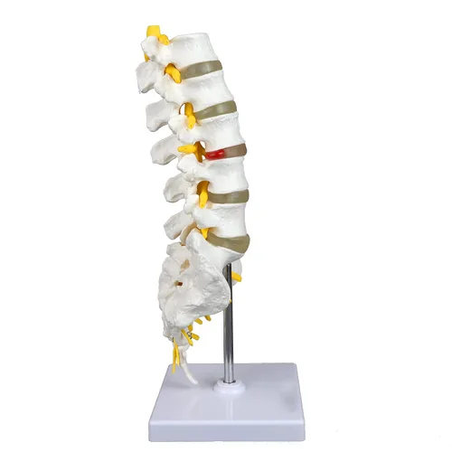 Miniatura 4 de Columna vertebral lumbar articulada de grado médico VAV262 Cuenta con 5 lumbares/vértebras con discos intervertebrales, nervios lumbares y médula