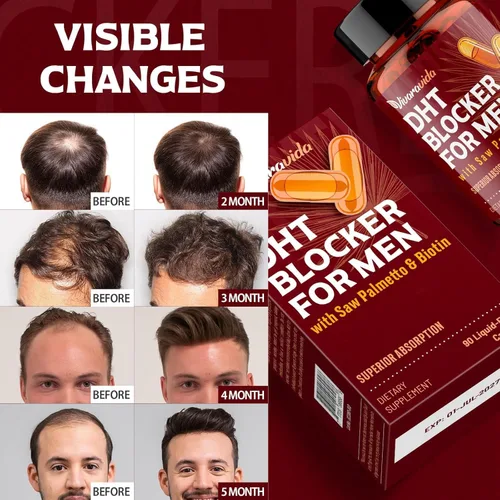 Miniatura 6 de DHT Blocker for Men Suplemento para el crecimiento del cabello con palma enana americana y biotina, vitaminas para el crecimiento del cabello