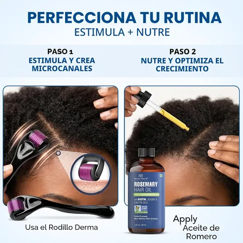 Miniatura 3 de Botanic Hearth Derma Roller para el crecimiento del cabello con aceite de romero para el cabello (2 onzas) Rodillo de microagujas de 0.09 pulgadas
