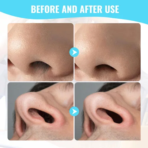 Miniatura 7 de Recortador de Vello Nasal 2 en 1, Cuchillo de Vello Nasal de Doble Cara Mejorado, Cortador de Vello Nasal Manual para Mujeres y Hombres (Crema, 3)