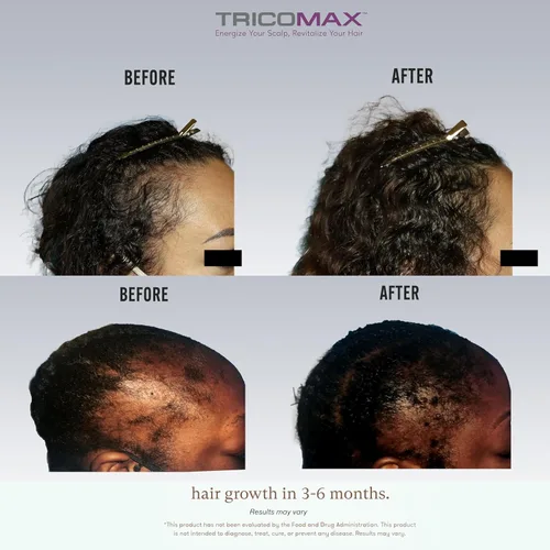 Miniatura 6 de Tricomax Suplemento para el crecimiento del cabello, apoya el cabello más grueso, más lleno y reduce la caída, ingredientes clínicamente estudiados