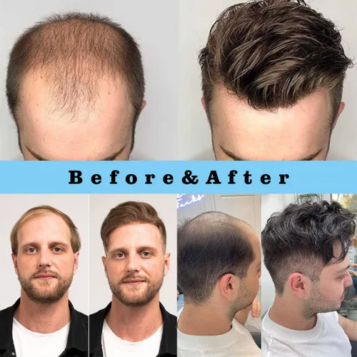 Miniatura 6 de Toupee para hombres, 8x10 pulgadas 0.002 in piel sintética fina para hombre, cabello humano tipo tupé, rubio sucio para hombre, peluca de cabello