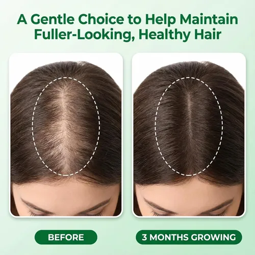 Miniatura 2 de Suero Roll-On para el cuidado del crecimiento del cabello con romero, niacinamida, jengibre, batana y aceite de ricino, nutre el cuero cabelludo