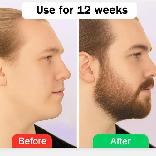 Miniatura 5 de Estimulante para Barba – Bálsamo de Crecimiento Ultra Potente, Bálsamo Estimulante para Barba, Hidrata y Fortalece la Barba, 100 ml / 3.5 oz