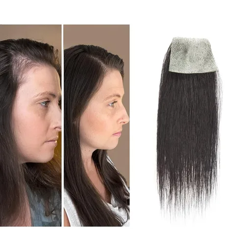 Miniatura 17 de Reemplazo de cabello humano con cicatrices, quemaduras accidentales sin vello para hombres y mujeres, pérdida de línea de cabello, cinta recta