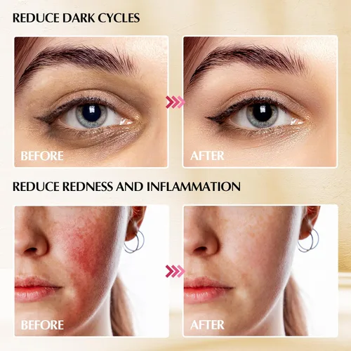 Miniatura 5 de Gua Sha Cryo Sticks 2 en 1, herramientas para el cuidado facial de la piel para mujeres, masaje facial y de ojos, suministros esteticistas de acero