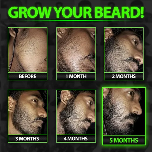 Miniatura 3 de Suero para el Crecimiento de la Barba - GROW Maximum XXL Aceite para el Crecimiento de la Barba para Hombres - Engrosa y Rellena Espacios Vacíos