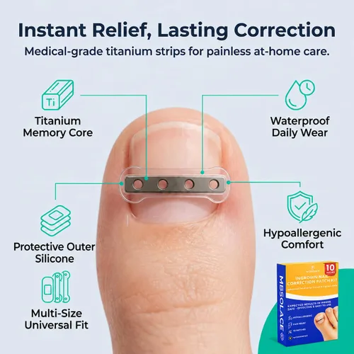 Miniatura 3 de Kit de tratamiento y corrector de uñas encarnadas de aleación de titanio de alta calidad, tiras correctoras hipoalergénicas para uñas de los pies