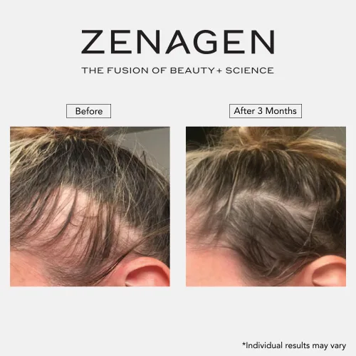 Miniatura 9 de ZENAGEN Revolve Champú Espesante para Mujeres Apoya la Apariencia de Cabello Más Abundante y de Aspecto Más Saludable, Desarrollado para Cabello