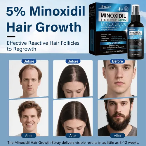 Miniatura 4 de 5% de minoxidil para hombres y mujeres, suero de tratamientos de pérdida de cabello con biotina batana y romero, spray de crecimiento del cabello