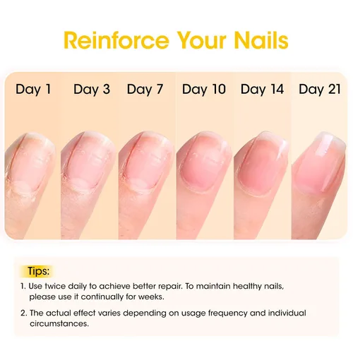 Miniatura 4 de GELLEN Pro Care Fortalecedor de Uñas de Jengibre, Tratamiento de Suero de Jengibre, 8-EN-1 Reparador de Uñas Transparente de Secado al Aire