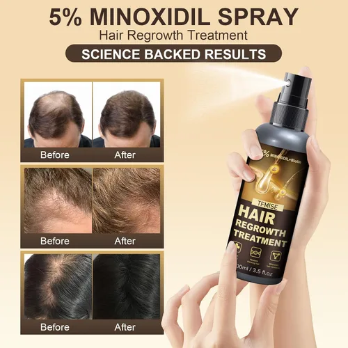 Miniatura 2 de Minoxidil Spray - 5% de minoxidil para hombres, productos de minoxidil para mujeres para el crecimiento del cabello, dispositivos de crecimiento