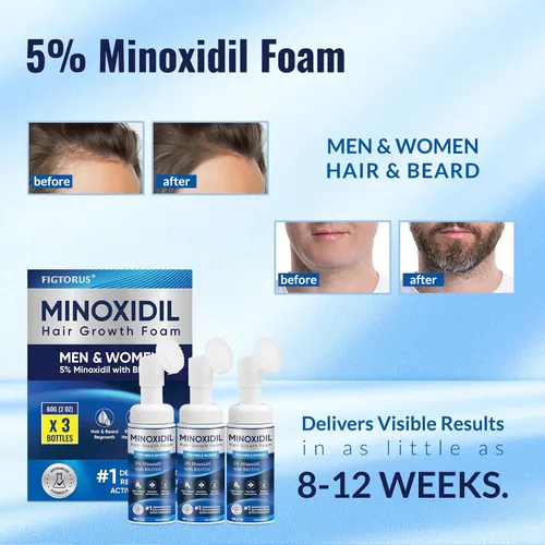 Miniatura 4 de Espuma de minoxidil al 5%, espuma de minoxidil para hombres, minoxidil para el crecimiento del cabello de mujeres, minoxidil para hombres y mujeres