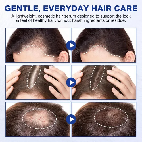 Miniatura 7 de Suero para el crecimiento del cabello, aceite de romero para el crecimiento del cabello, ayuda al crecimiento del cabello para hombres y mujeres