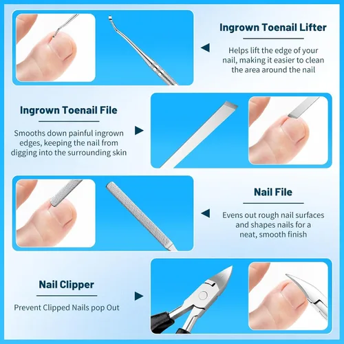 Miniatura 6 de SelfTek Kit de uñas encarnadas – Kit profesional de corrector de uñas encarnadas con tiras transpirables y parches curvos, lima sin dolor