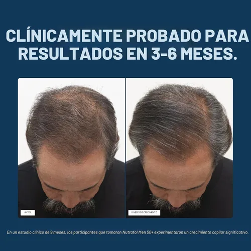 Miniatura 4 de Nutrafol Suplementos para el crecimiento del cabello para hombres de más de 50 años, clínicamente probados para una cobertura visiblemente más