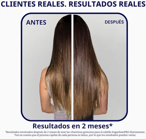 Miniatura 7 de Sugarbear Hair - Gomitas de vitamina para el cabello, suministro de 2 meses, biotina de fuerza extra 6000mcg, crecimiento para hombres y mujeres