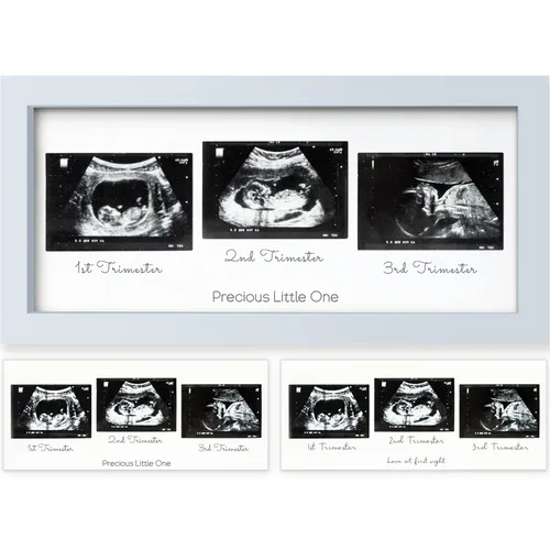 Miniatura 19 de KeaBabies Marco de Fotos de Ecografía para Bebé - Marcos Modernos de Fotos de Ultrasonido para Futuras Mamás, Regalos de Primer Embarazo para Mamá
