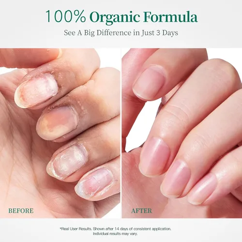 Miniatura 2 de Apuree Aceite de cutícula de base biológica de 1 onza: 100% puro Humedad profunda para cutículas dañadas Extracto de rosa negra Aceite