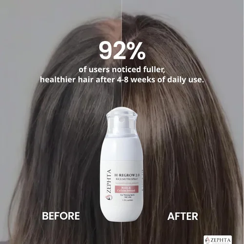Miniatura 5 de Zephta H-Regrow - Spray para el crecimiento del cabello, con agua de arroz, biotina, aloe vera, cafeína y jengibre, producto para el crecimiento