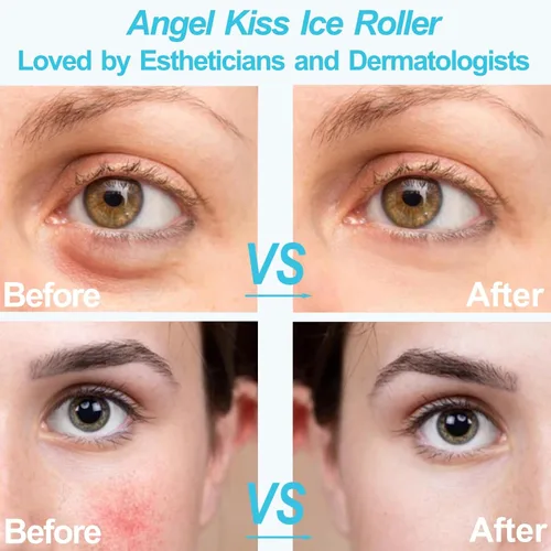 Miniatura 5 de Angel Kiss Rodillo de hielo para ojos faciales, idea de regalo para mujeres, masajeador de terapia de frío para reducir la hinchazón