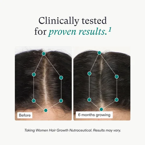 Miniatura 4 de Nutrafol Suplemento para el crecimiento del cabello para mujeres y péptidos de colágeno en polvo, de 18 a 44 años, formulado por médicos para un