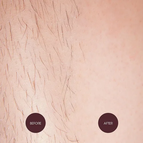 Miniatura 7 de Nad's Waxing Dots - Cuentas de cera dura de fresas y crema, fórmula sin tiras para microondas para mujeres