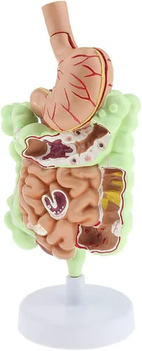 Miniatura 3 de KESOTO Modelo de Patología Gastrointestinal Humana Modelo Coronal Gástrico del Tracto Digestivo para Estudiantes Escolares Aprendizaje